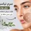 فواید نیاسینامید برای منافذ باز